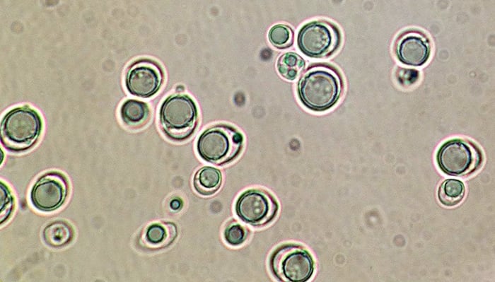 Mikroskopbild av jästceller (Lipomyces starkeyi)